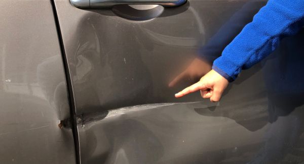 car dents